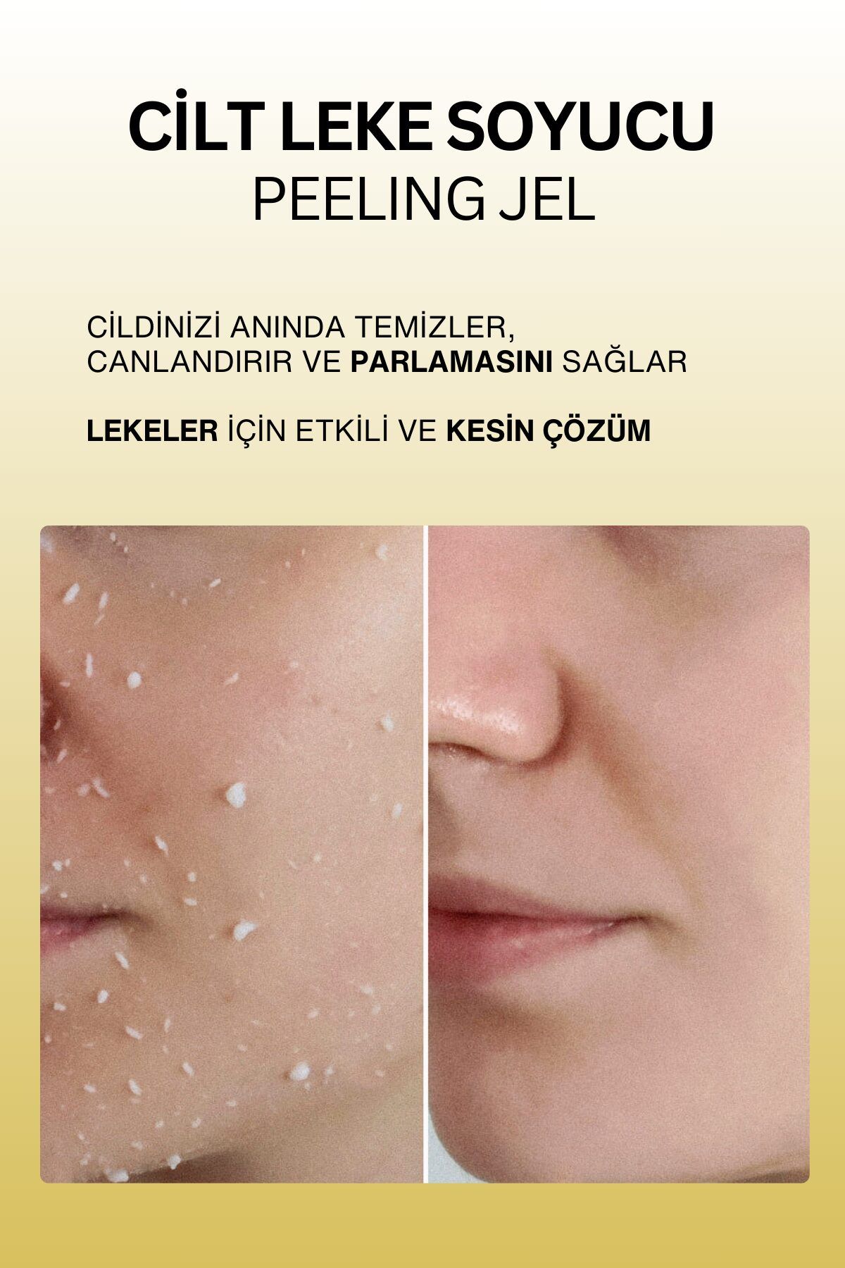 Dr. Wsay Yüz Vücut Peeling Jel Lazer Epilasyon Sonrası Ölü Deri Cilt Leke Soyucu Krem