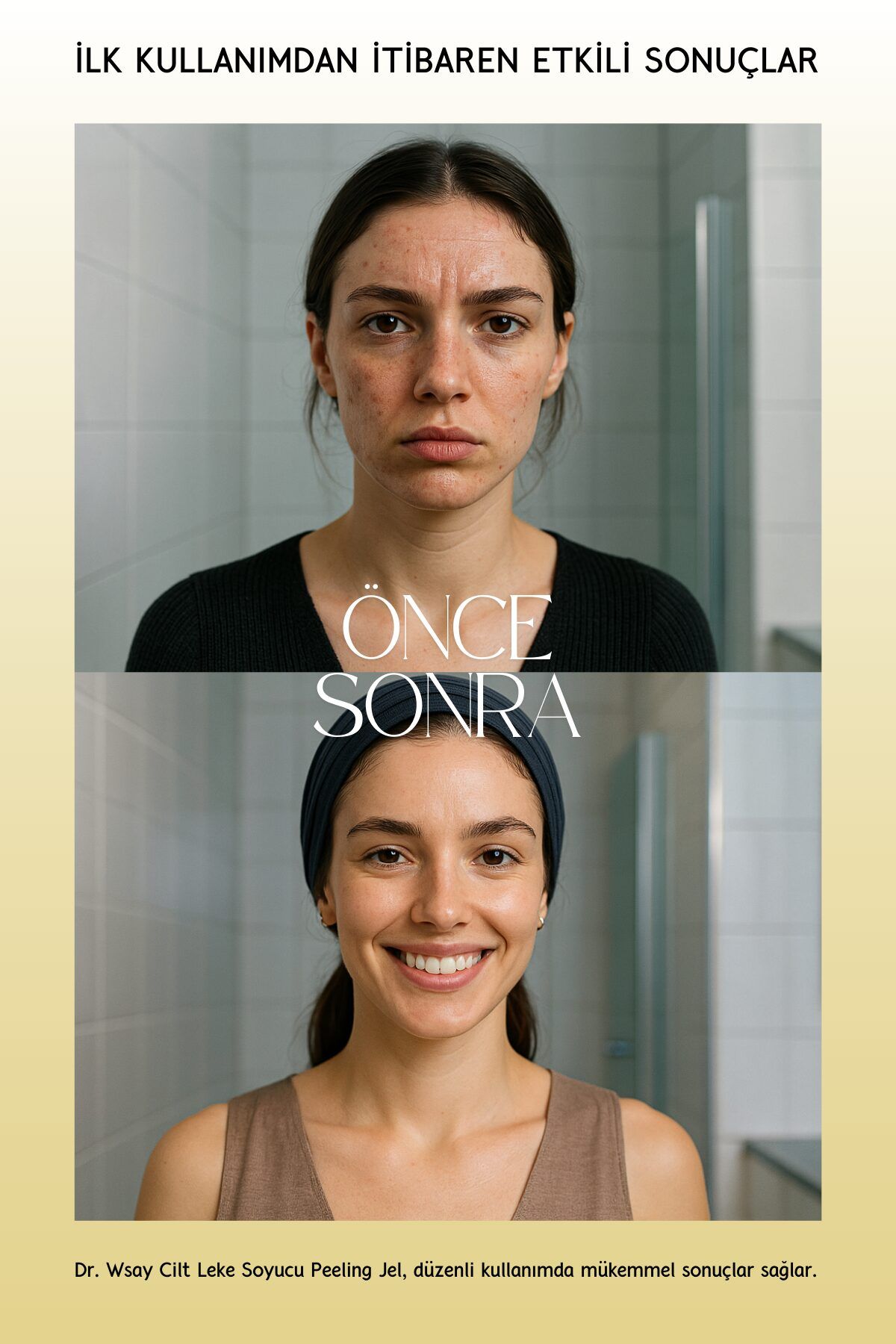 Dr. Wsay Yüz Vücut Peeling Jel Lazer Epilasyon Sonrası Ölü Deri Cilt Leke Soyucu Krem