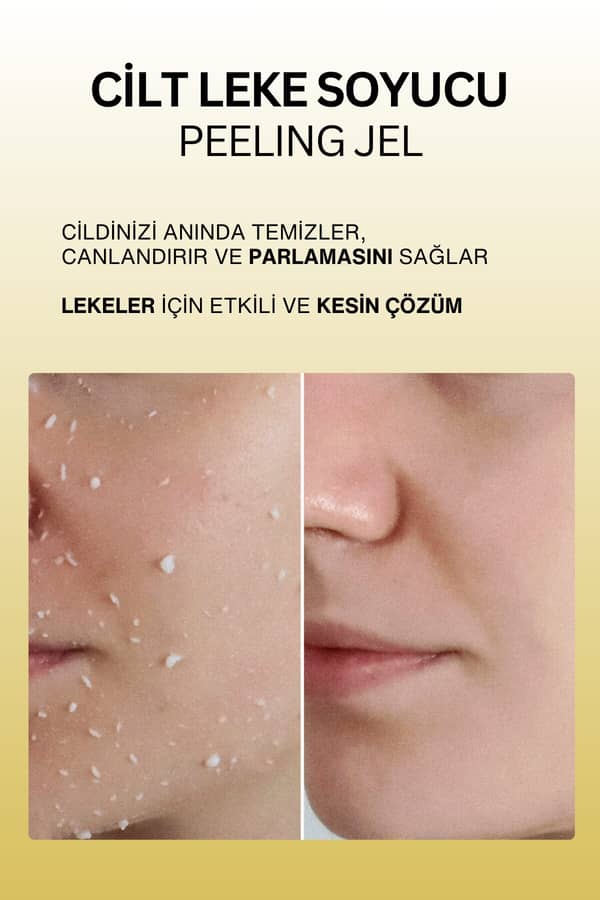 Dr. Wsay Yüz Vücut Peeling Jel Lazer Epilasyon Sonrası Ölü Deri Cilt Leke Soyucu Krem